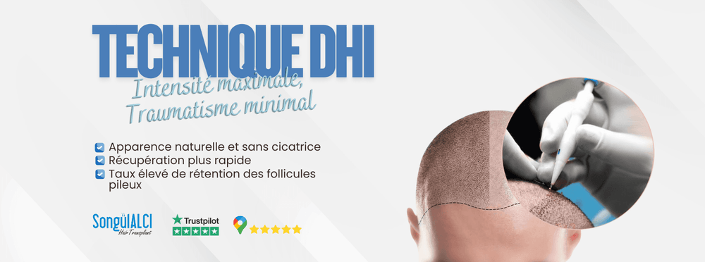 Songül Alcı Hair Transplantation Clinic Turkey