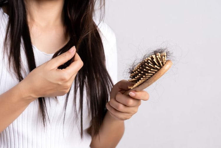 Songül Alcı -  Kadın Tipi Saç Dökülmesi